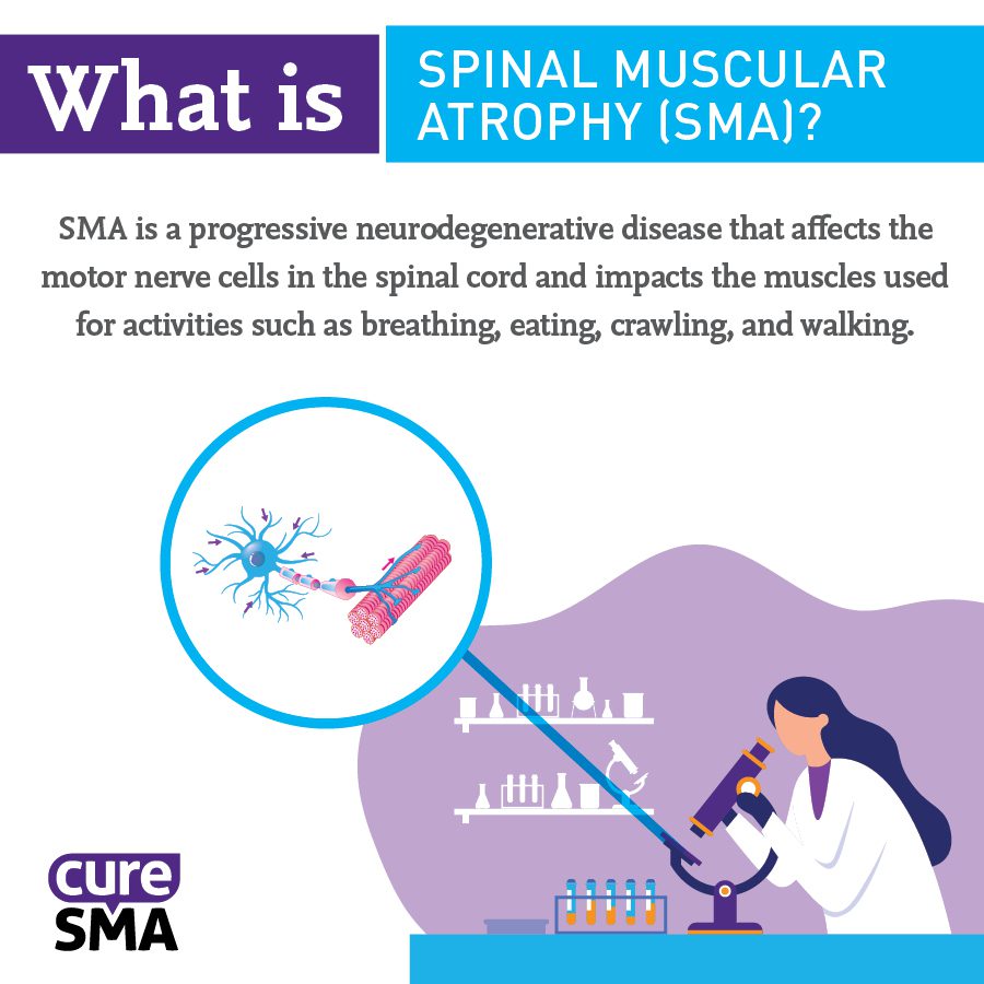 Colorful image of purple, light purple and light blue of a scientist working in a lab, which reads What is Spinal Muscular Atrophy, SMA is a progressive neurodegenerative disease that affects the motor nerve cells in the spinal cord and impacts the muscles used for activities such as breathing, eating, crawling, and walking. CureSMA is in the bottom left-hand corner